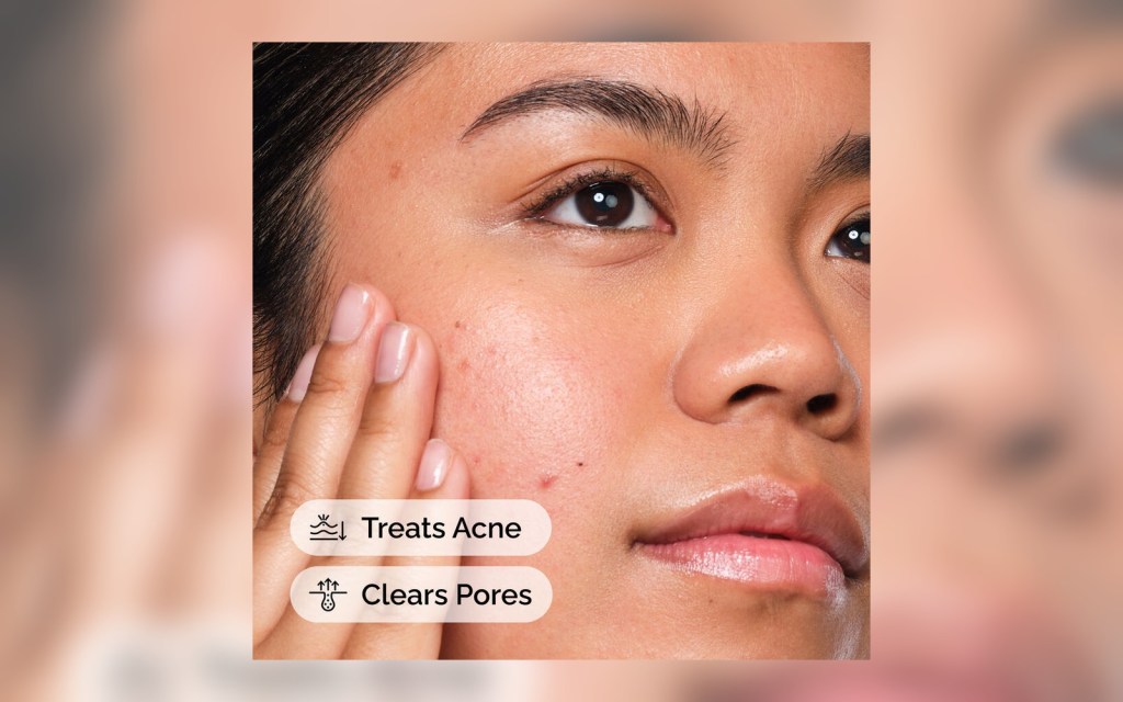 The Ordinary salicylic acid solution being applied to skin